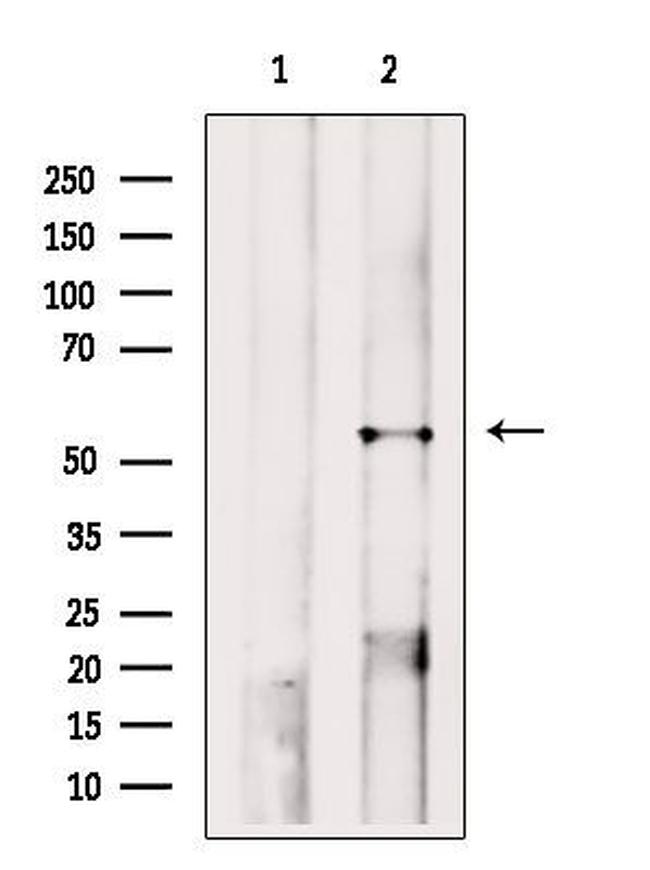 A2BP1 Antibody in Western Blot (WB)