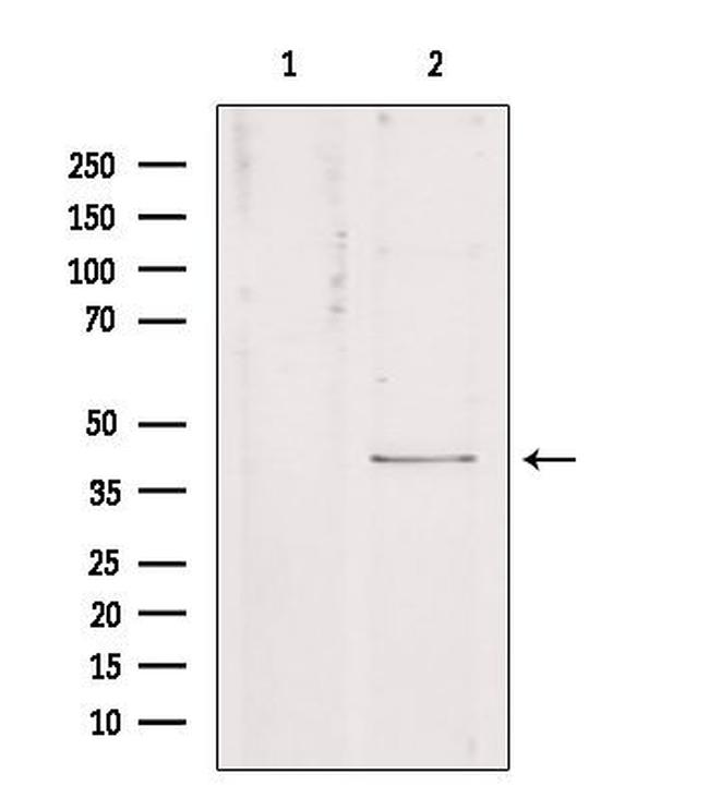 Kir4.1 (KCNJ10) Antibody in Western Blot (WB)