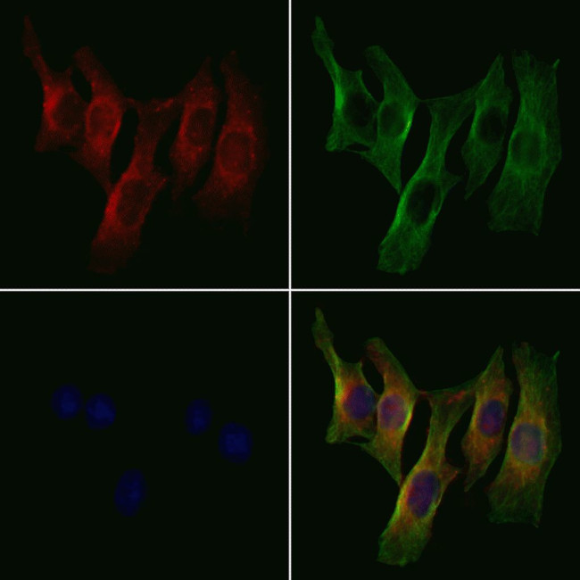 B4GALT2 Antibody in Immunocytochemistry (ICC/IF)