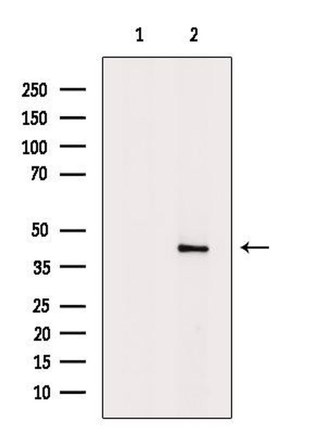 B4GALT2 Antibody in Western Blot (WB)