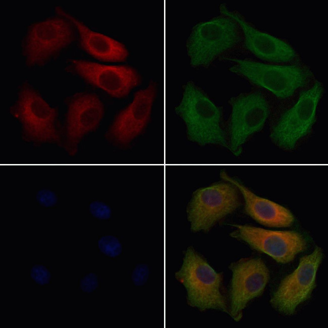 CABP4 Antibody in Immunocytochemistry (ICC/IF)