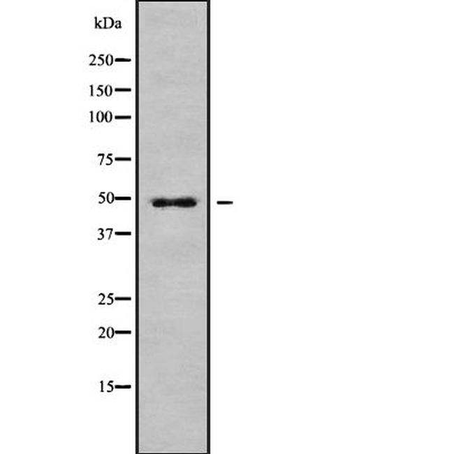 CHST12 Antibody in Western Blot (WB)