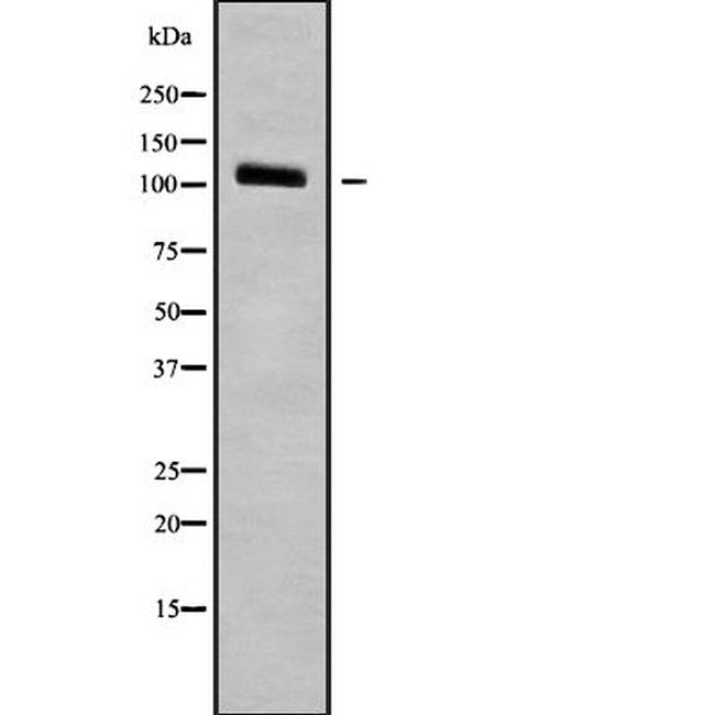 alpha N-Catenin Antibody in Western Blot (WB)