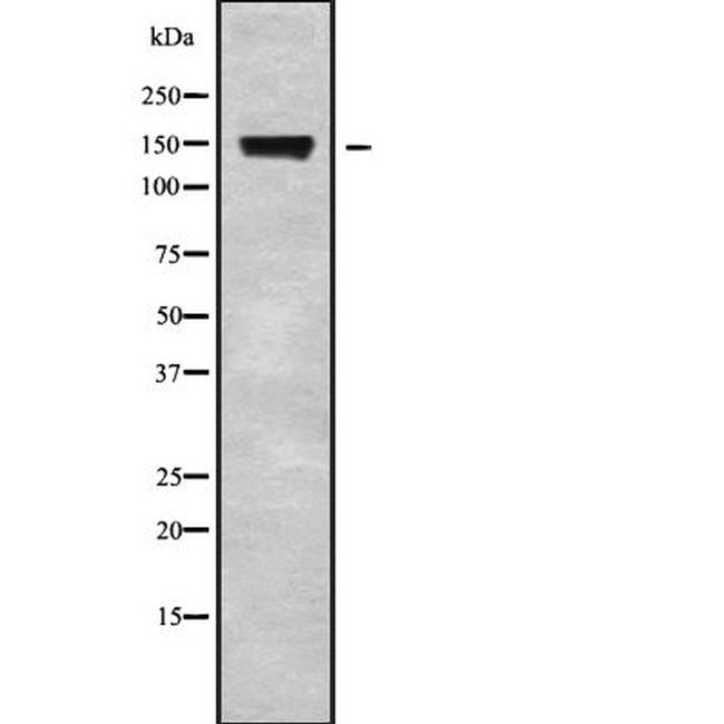 CSPP1 Antibody in Western Blot (WB)