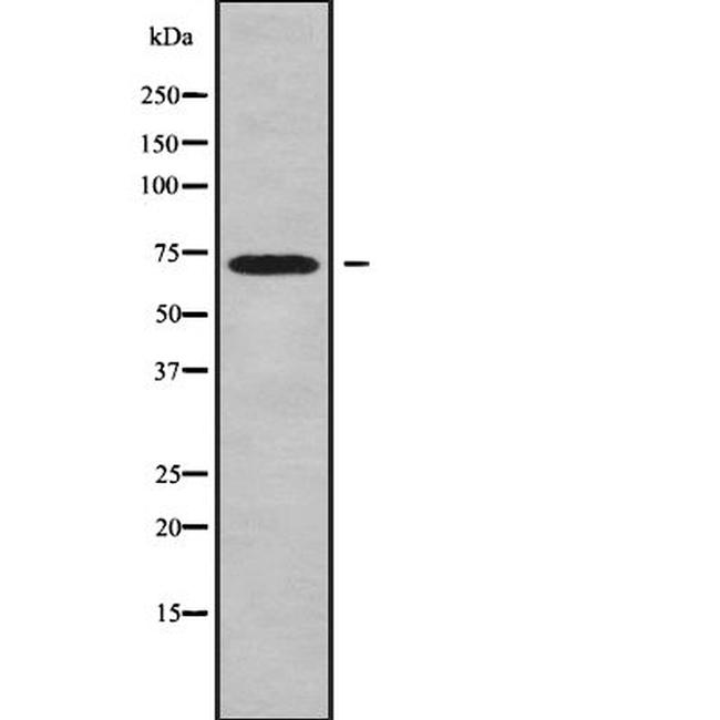 Factor XI Antibody in Western Blot (WB)