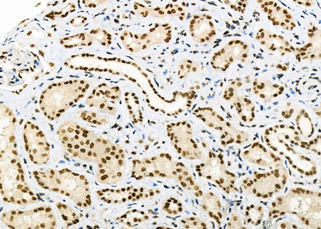 DHRS1 Antibody in Immunohistochemistry (Paraffin) (IHC (P))