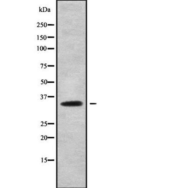 DHRS9 Antibody in Western Blot (WB)