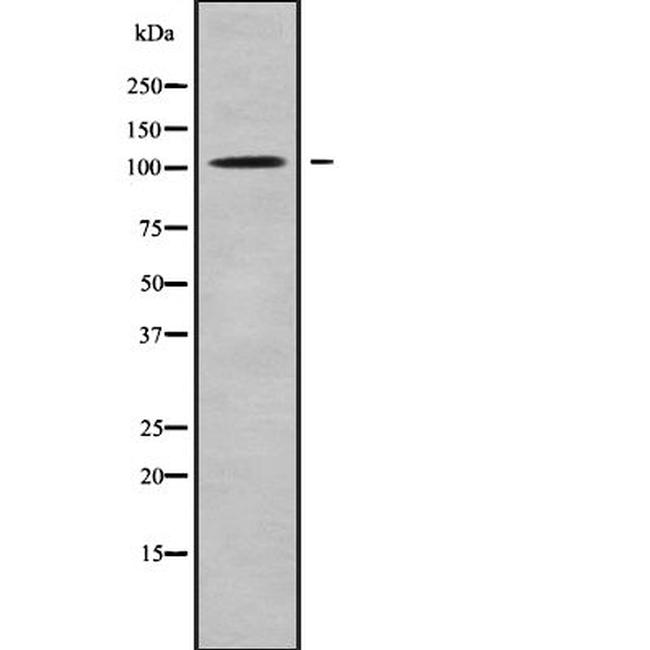 HACE1 Antibody in Western Blot (WB)