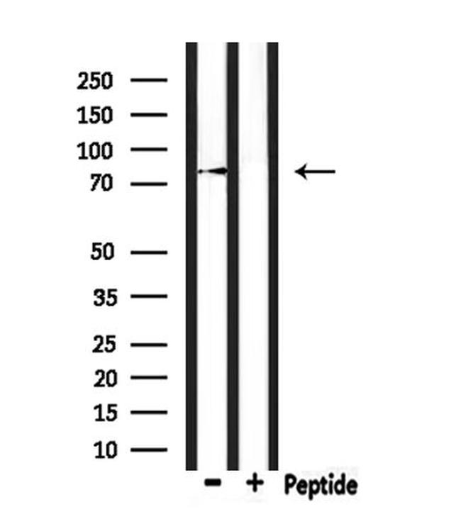 LRSAM1 Antibody in Western Blot (WB)