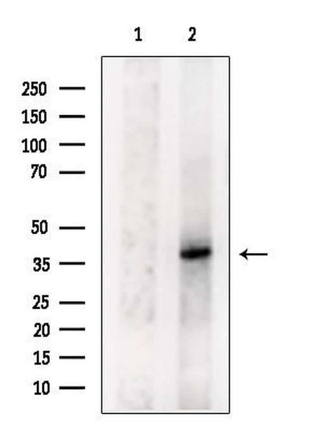 MARCH9 Antibody in Western Blot (WB)