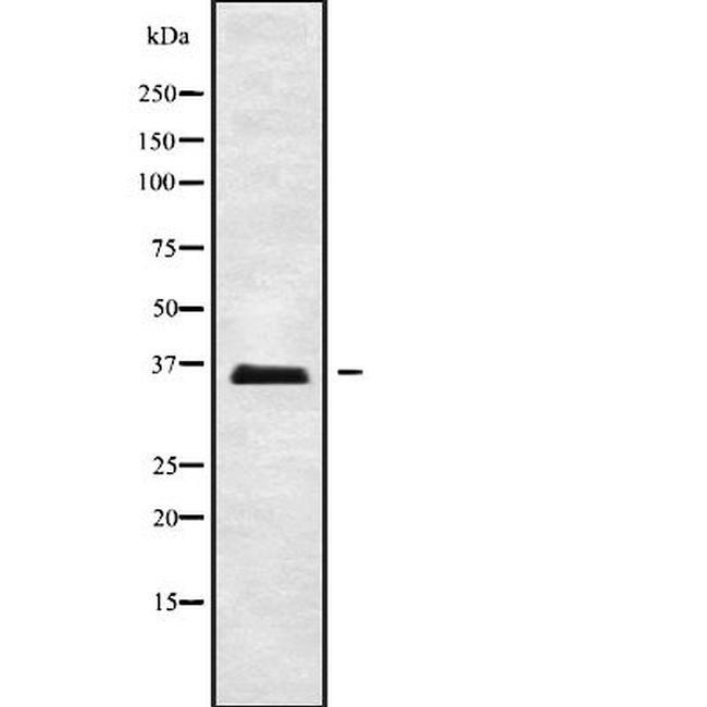 ELOVL2 Antibody in Western Blot (WB)