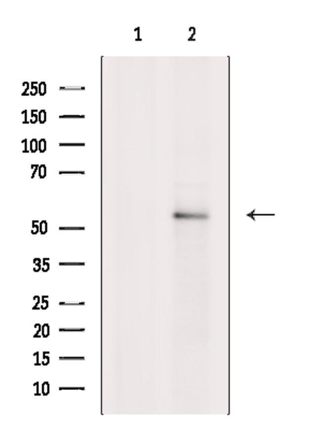 GABRR2 Antibody in Western Blot (WB)