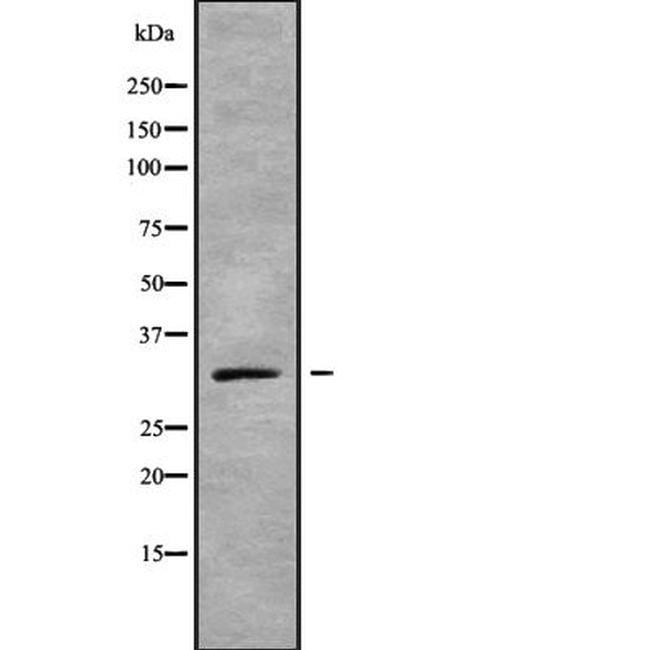 Connexin 31.1 Antibody in Western Blot (WB)