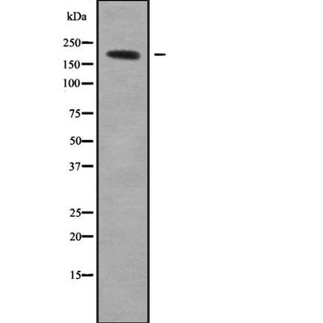QSER1 Antibody in Western Blot (WB)
