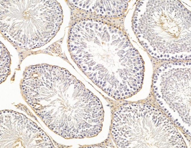 HLA-DQB2 Antibody in Immunohistochemistry (Paraffin) (IHC (P))