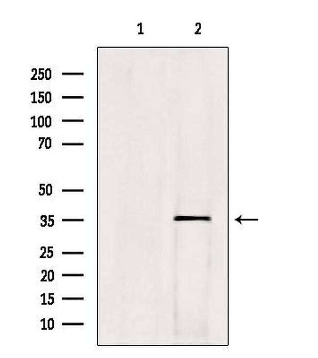 HOXC13 Antibody in Western Blot (WB)