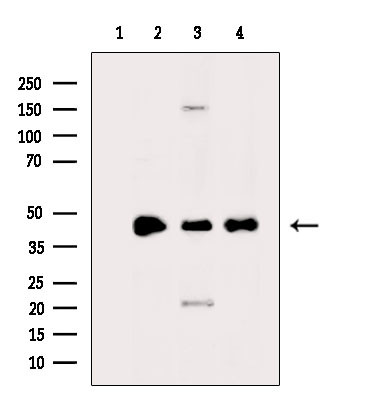 HOXD11 Antibody in Western Blot (WB)