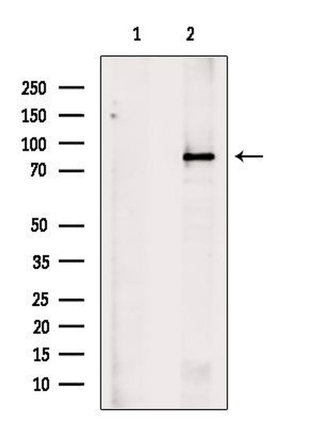 PCQAP Antibody in Western Blot (WB)