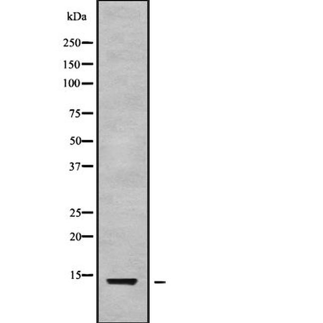 NMB Antibody in Western Blot (WB)