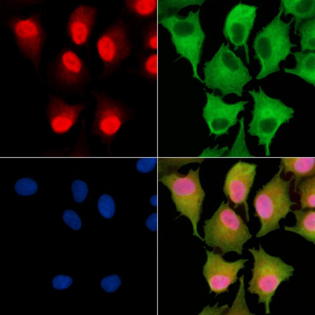 TNP2 Antibody in Immunocytochemistry (ICC/IF)