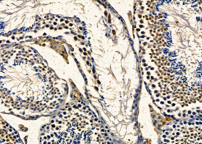 TNP2 Antibody in Immunohistochemistry (Paraffin) (IHC (P))