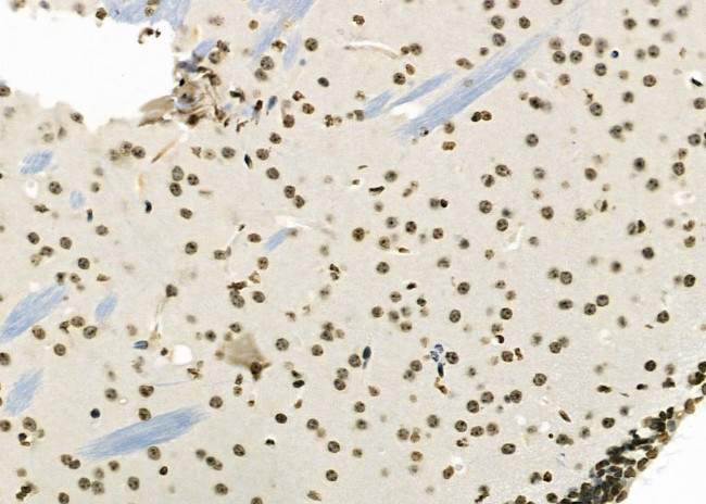 NOL7 Antibody in Immunohistochemistry (Paraffin) (IHC (P))