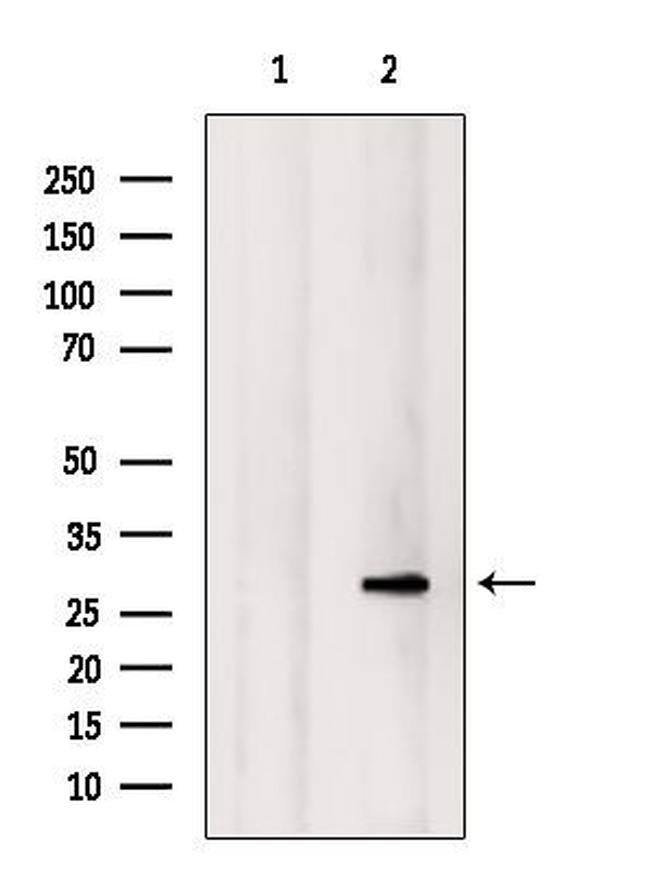 NOL7 Antibody in Western Blot (WB)