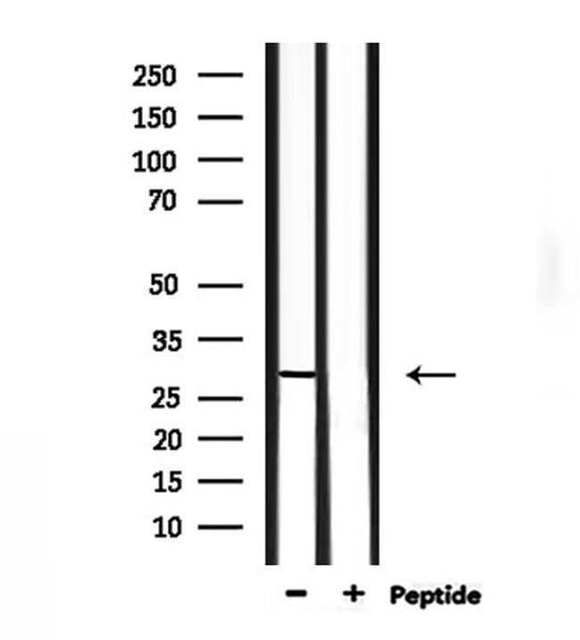 NOL7 Antibody in Western Blot (WB)