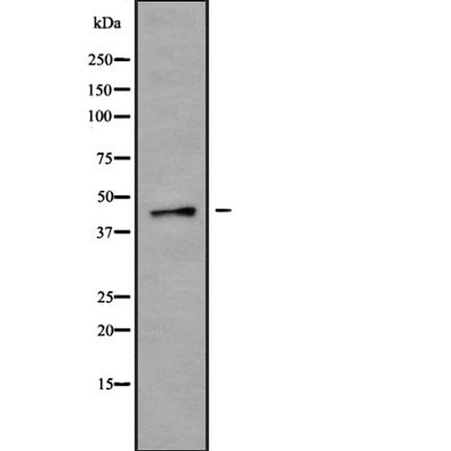 P2X1 Antibody in Western Blot (WB)