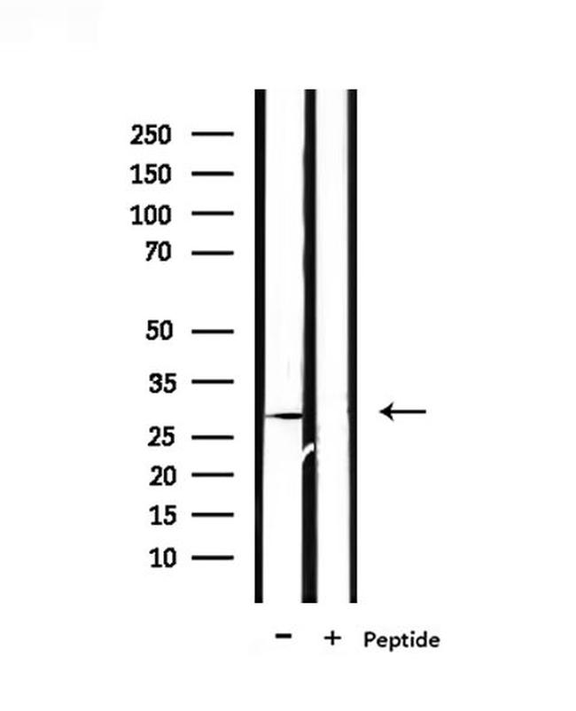 PEX11A Antibody in Western Blot (WB)