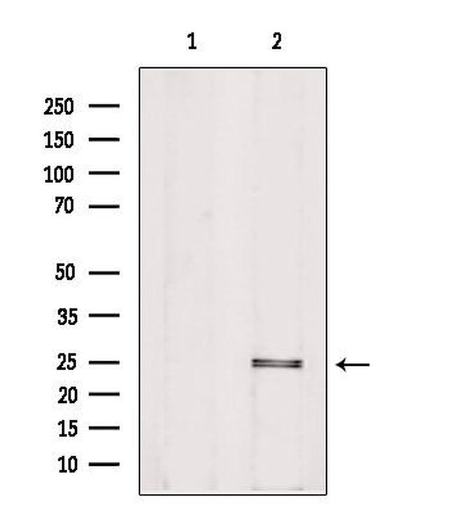 PIGF Antibody in Western Blot (WB)