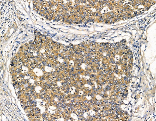 GPLD1 Antibody in Immunohistochemistry (Paraffin) (IHC (P))