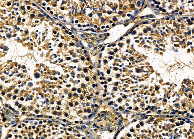 GPLD1 Antibody in Immunohistochemistry (Paraffin) (IHC (P))