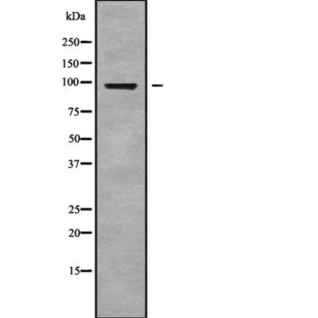 GPLD1 Antibody in Western Blot (WB)