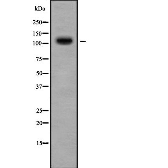 PLD2 Antibody in Western Blot (WB)
