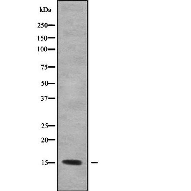 KCNE1L Antibody in Western Blot (WB)