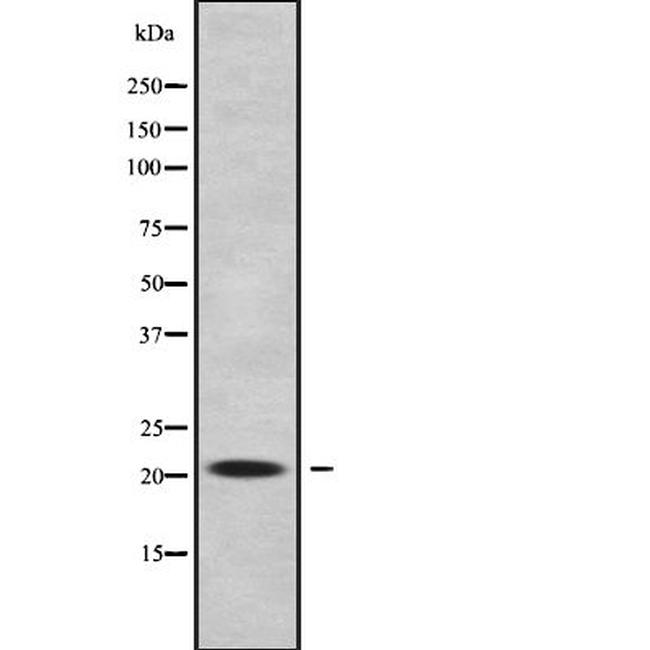 RABL5 Antibody in Western Blot (WB)
