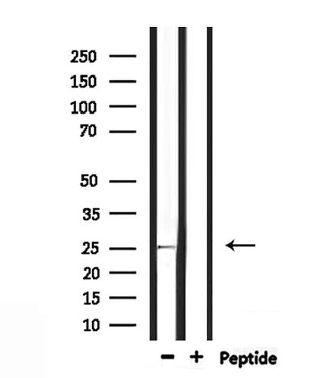 RAB32 Antibody in Western Blot (WB)