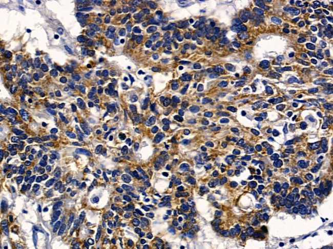 SLC6A14 Antibody in Immunohistochemistry (Paraffin) (IHC (P))