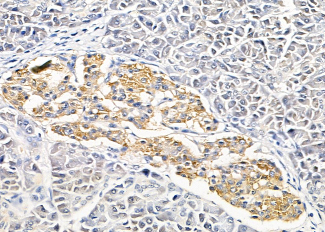 SLC4A7 Antibody in Immunohistochemistry (Paraffin) (IHC (P))