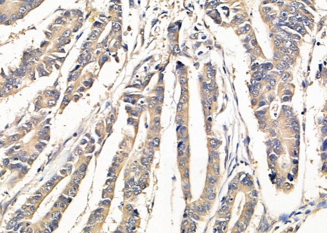 SLC4A7 Antibody in Immunohistochemistry (Paraffin) (IHC (P))