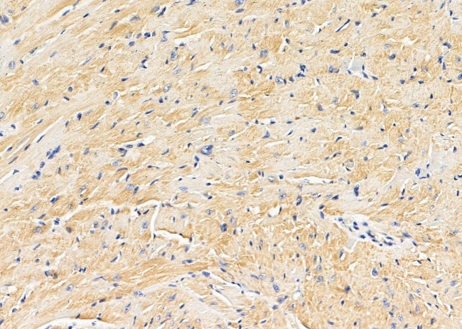 SLC4A7 Antibody in Immunohistochemistry (Paraffin) (IHC (P))