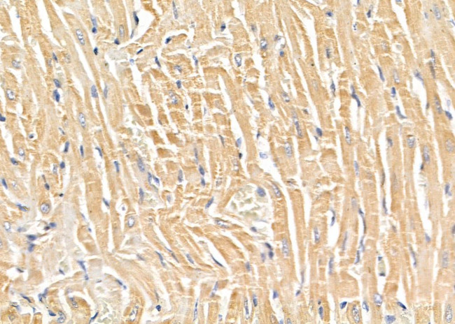 SLC4A7 Antibody in Immunohistochemistry (Paraffin) (IHC (P))