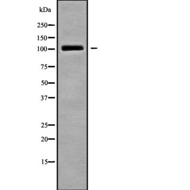 TRAK2 Antibody in Western Blot (WB)