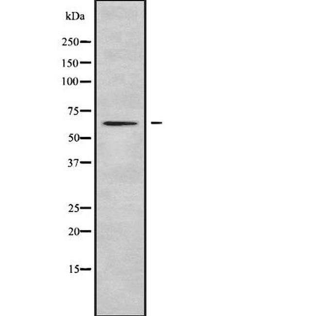 Ubiquilin 2 Antibody in Western Blot (WB)