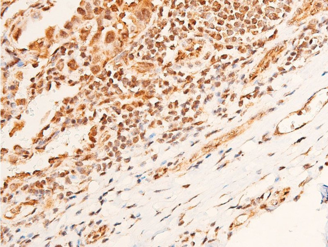 Phospho-Chk1 (Ser296) Antibody in Immunohistochemistry (Paraffin) (IHC (P))