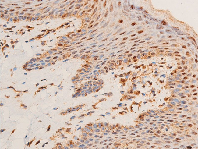 Phospho-Chk1 (Ser296) Antibody in Immunohistochemistry (Paraffin) (IHC (P))