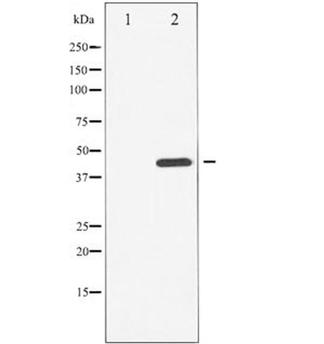 Phospho-Chk1 (Ser296) Antibody in Western Blot (WB)