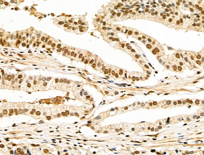 HDAC7 Antibody in Immunohistochemistry (Paraffin) (IHC (P))