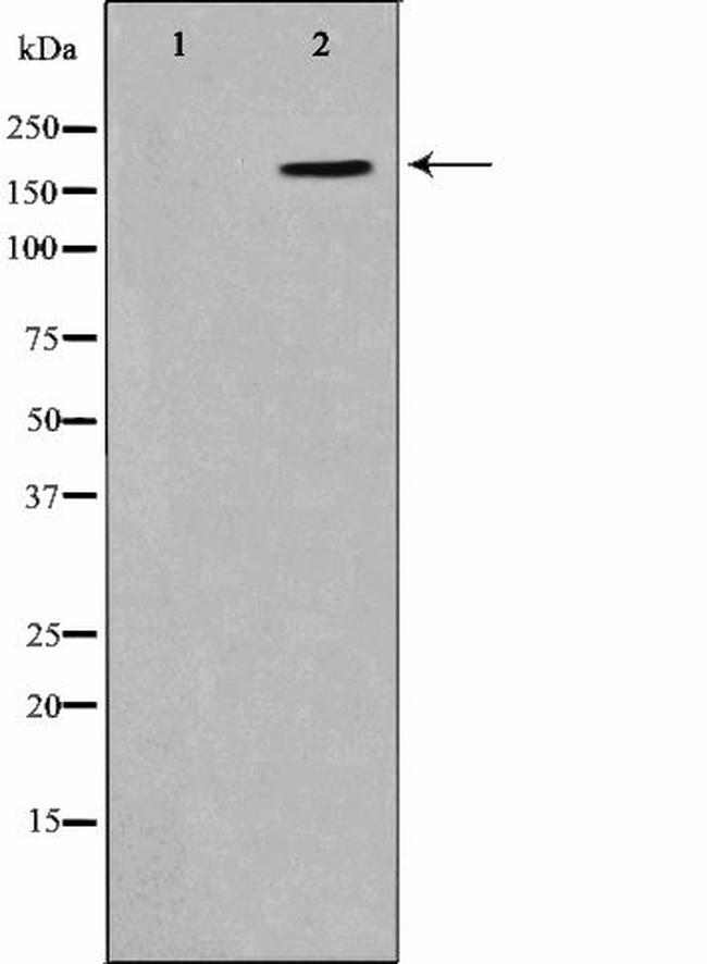Phospho-CD227 (Mucin 1) (Tyr1229) Antibody in Western Blot (WB)